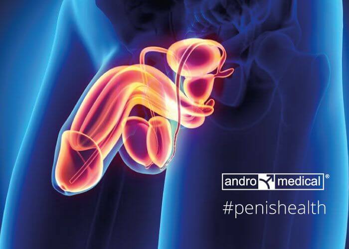 Androsurgery post surgery peyronie's disease penis curve